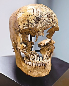 一具14岁少女骸骨去年在美国弗吉尼亚州詹姆斯敦出土，鉴证专家分析后发现，其头颅有被试图强行抽取大脑的痕迹。图自香港文汇报