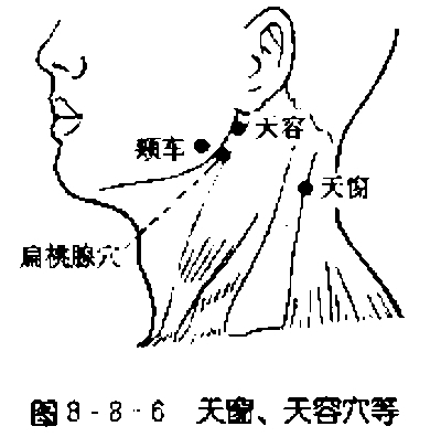 天容天窗