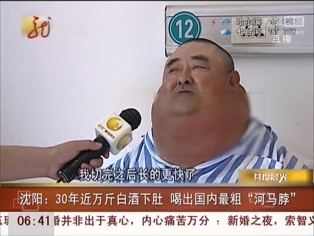 30年喝近万斤白酒喝出国内最粗河马脖