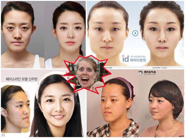 31个惊人韩国整容案例让你不再信偶巴图