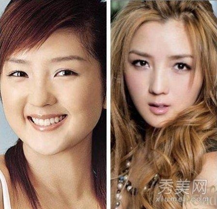 原标题[霍思燕周韦彤杨幂张馨予 女星隆乳整形大胸比美(组图]