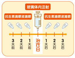 玻璃体内注射后可能出现的异常情况是什么?