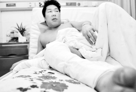 湖南湘雅二医院，刘华能的右小腿被收债人员砍废