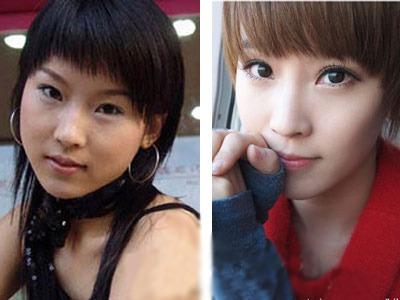 杨幂刘恺威王丽坤angelababy 明星整容谁最成功