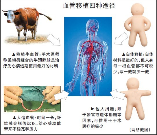 什么心什么肺成语_成语故事图片(3)