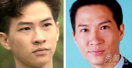 黄晓明刘恺威郭敬明土鳖成型男 整容变帅的男星(图)