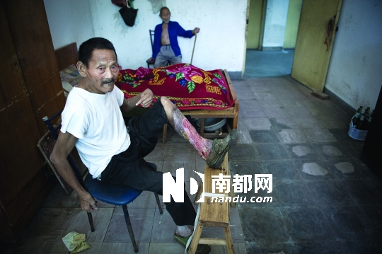 如今住在江山新塘边镇敬老院的姜录才一辈子孤残，烂脚病折磨了他70年。
