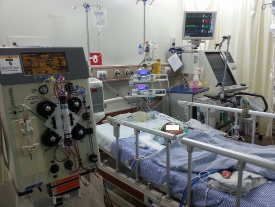 上海市儿童医院成功抢救1例危重症EV71患儿