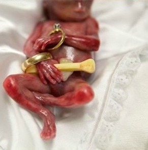 19周胎儿因早产去世 下葬前家人轮流凝视