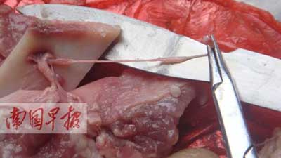 广西:居民称猪肉有"虫" 实为血管组织(图)