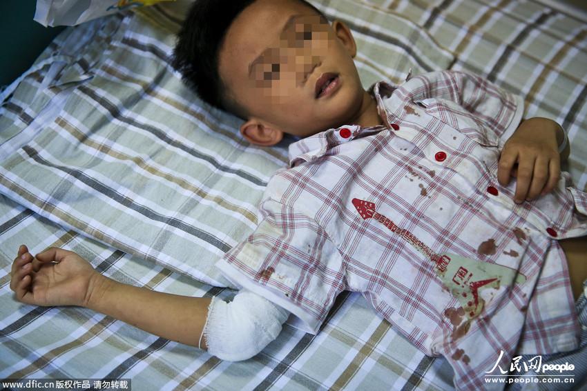 广州爆炸事故13名幼童受伤 孩子睡梦中血流如注