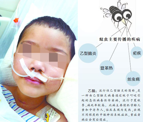 重庆:5岁女孩遭蚊子叮咬 昏迷已超82天(图)