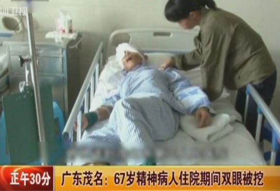 广东茂名67岁精神病人住院期间双眼被挖
