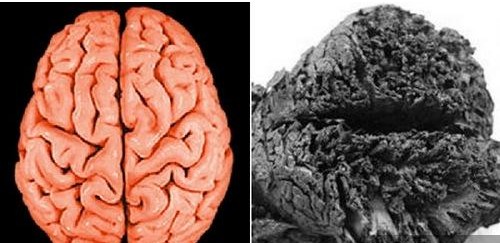 科学家在土耳其发现了现存世界上最古老的人类大脑,因为富含矿物的
