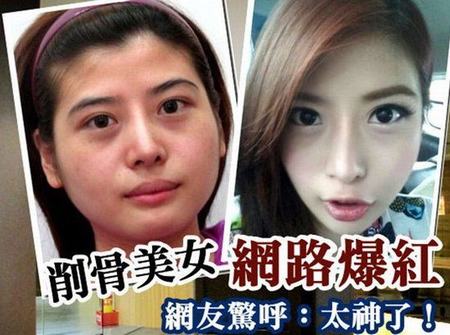 台湾26岁女子整容前后对比