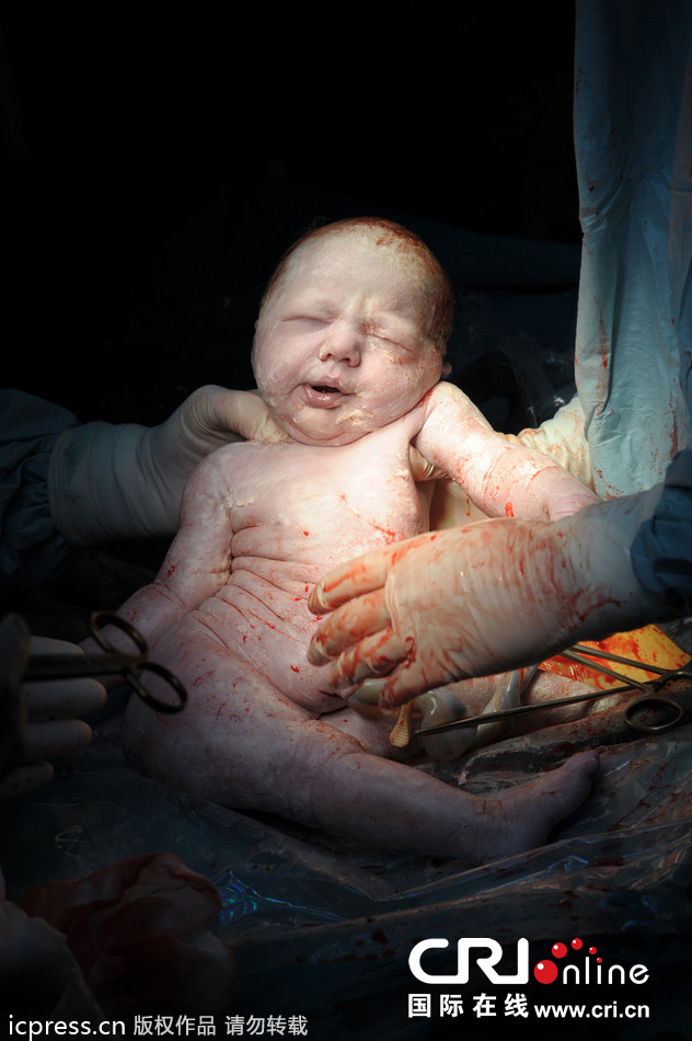 生命的奇迹:丹麦摄影师真实记录婴儿出生震撼