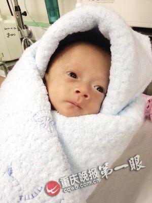 小双出院时体重2000克