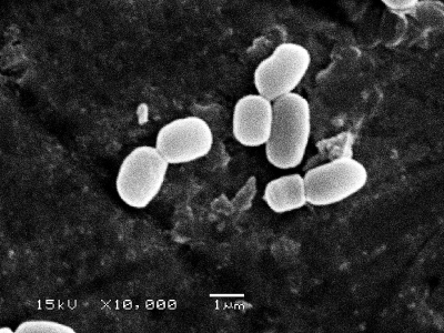 我国发现地球微生物新种:兵马俑芽孢杆菌(组图)