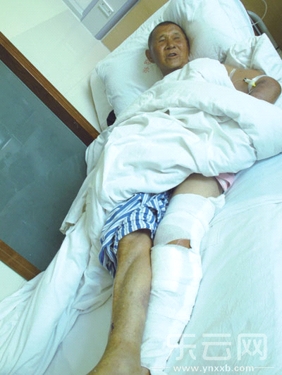 81岁的毕自昌老人躺在病床上，他的双手和一条腿都被打骨折了。