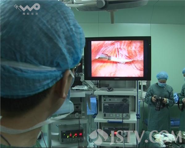 江苏首例小儿外科3d腹腔镜手术成功实施(组图