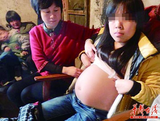 患“大肚子”病的花季少女彭晚露。 记者 谢能武 摄