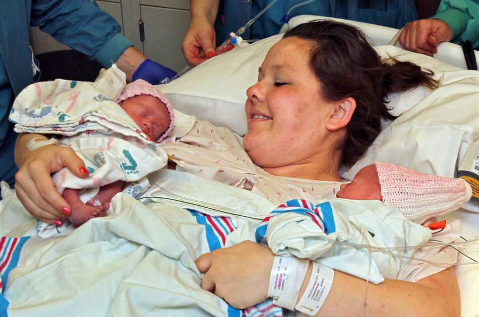 美国罕见单羊膜双胞胎女婴牵手出生(高清组图)