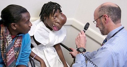 海地女孩移除面部3.6斤重肿瘤获新颜