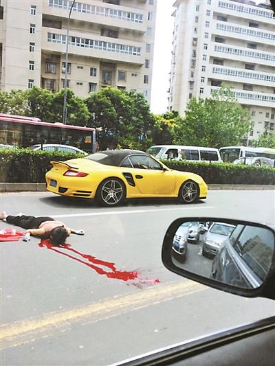 保时捷撞上行人后，右侧车头出现凹陷 摄影/本报记者 李晨