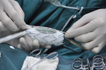 患者被一次性植9个心脏支架 相关法规亟待出台
