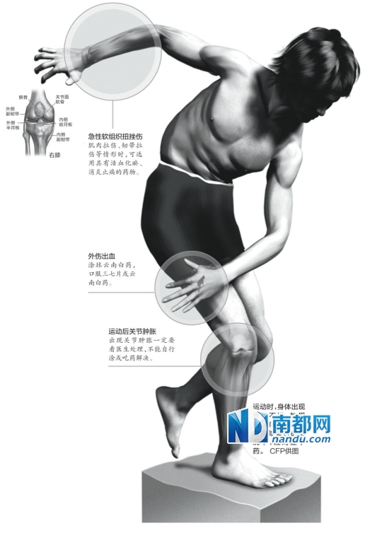 长期大运动量,膝关节磨损致软骨损伤(图)-中国