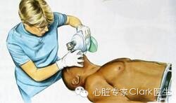 简易呼吸器(球囊面罩)是最简单的一种人工机械通气方式,它是由一个