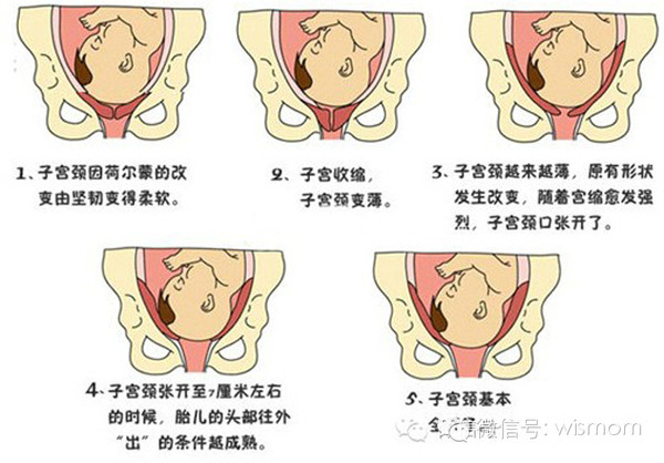 生孩子的真实过程 从规律性子宫收缩开始到胎儿胎盘娩出为止的全过程