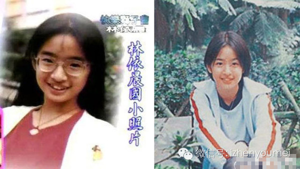 国小时的林依晨还是个牙套四眼小妹,牙齿矫正摘掉眼镜后的林姑娘