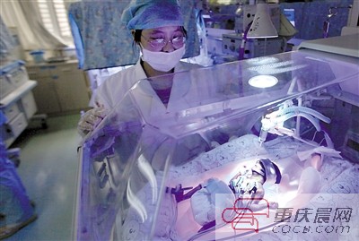 重庆第一早产儿"筷子宝宝"顽强存活(组图)
