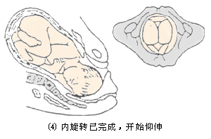 作用使胎头沿骨盆轴下降向下前方向转向上,胎头的枕骨下部达到耻骨联