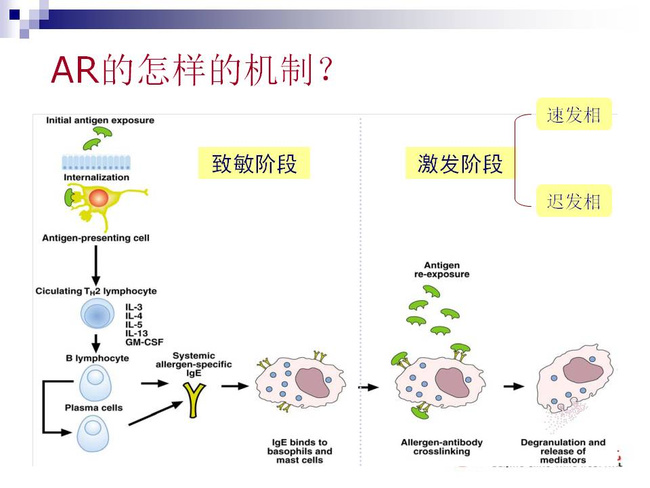 过敏性(变应性)鼻炎的诊断与治疗