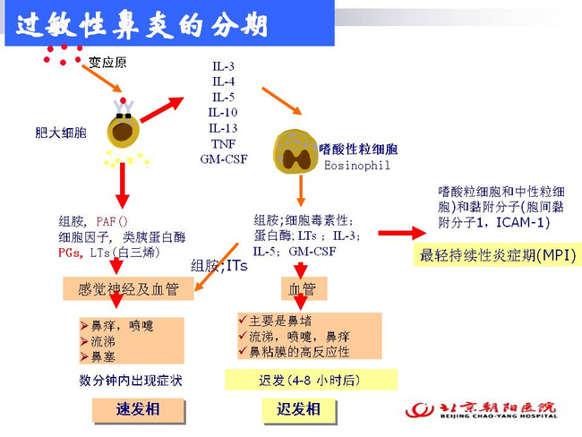 过敏性(变应性)鼻炎的诊断与治疗