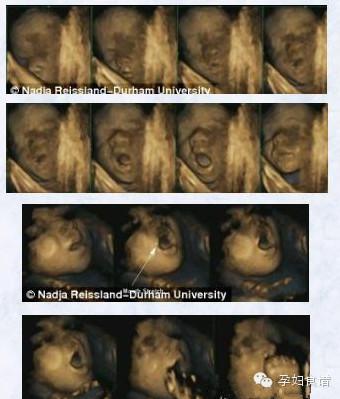 到了第36周,绝大多数胎儿在触碰口部前会张开小嘴,科学家表示这说明