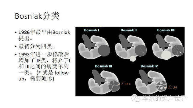 得了肾囊肿怎么办