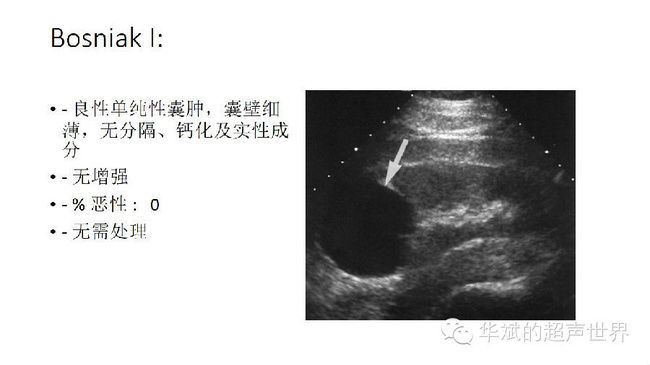 得了肾囊肿怎么办