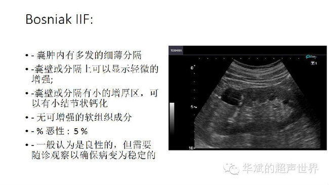 右肾囊肿伴钙化怎么办