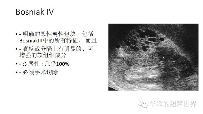 得了肾囊肿怎么办