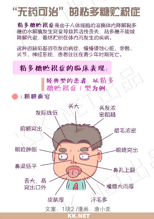 "无药可治"的粘多糖贮积症