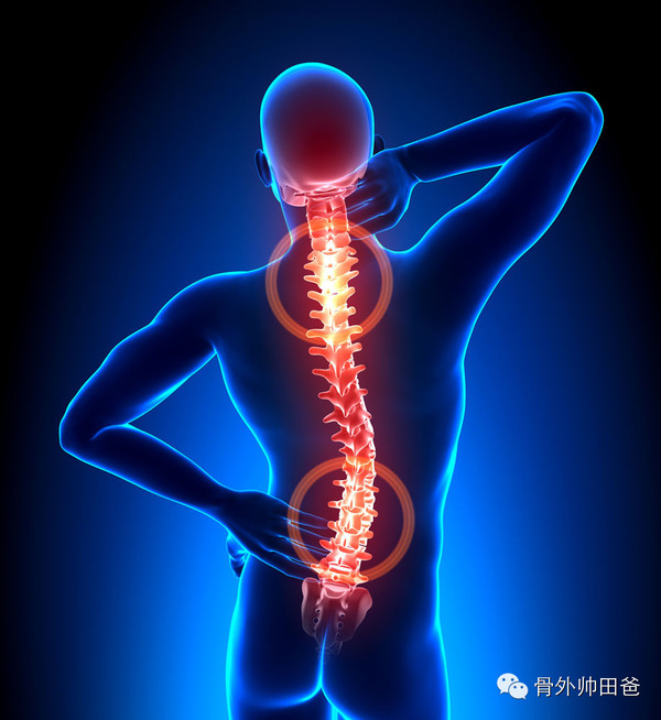 知识库 正文  强直也会出现腰腿痛,但是疼痛的部位不同于腰椎间盘突出