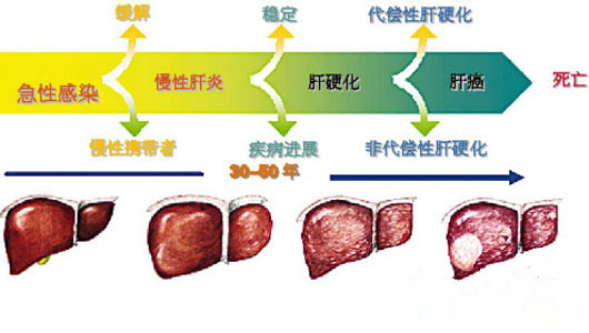 通常先变为肝硬化再发生肝癌.早期没什么临床表现,通过查afp查出来.