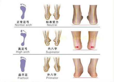 关于幼儿学步、O型腿、X型腿以及鞋子选购的