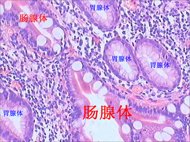 癌症知多少(31)慢性胃炎怎么办