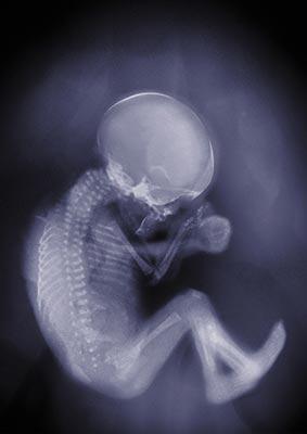 你从未见过的胎儿神奇图片(组图)