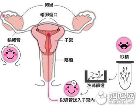 卖卵代孕只为还信用卡!代孕代价惨不忍睹