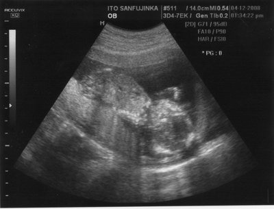 孕期 胎儿发育    孕妇做b超检查,安全简便,效果可靠,没有痛苦,对胎儿